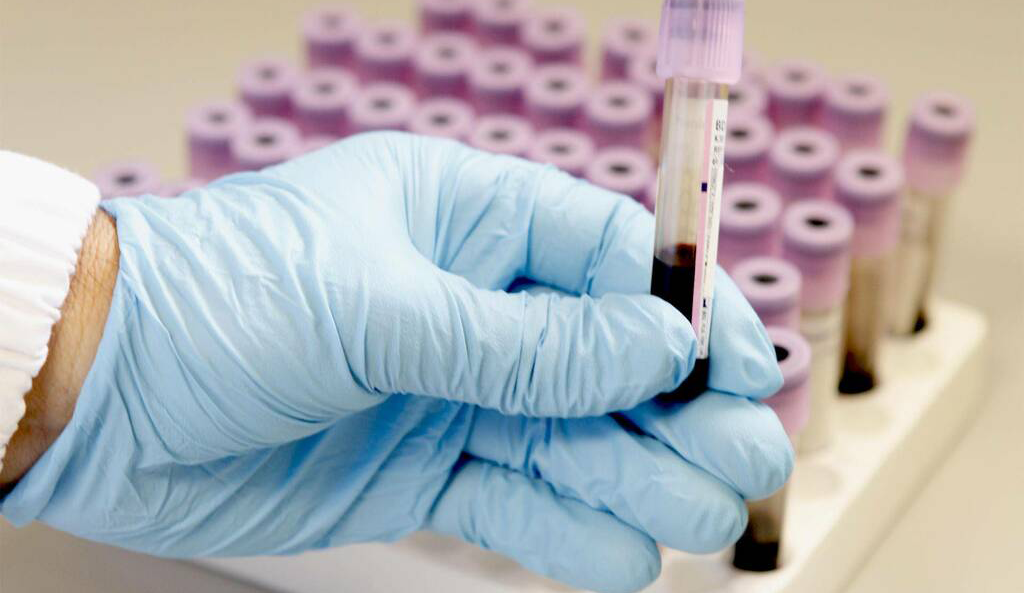 liquido biologico in provetta